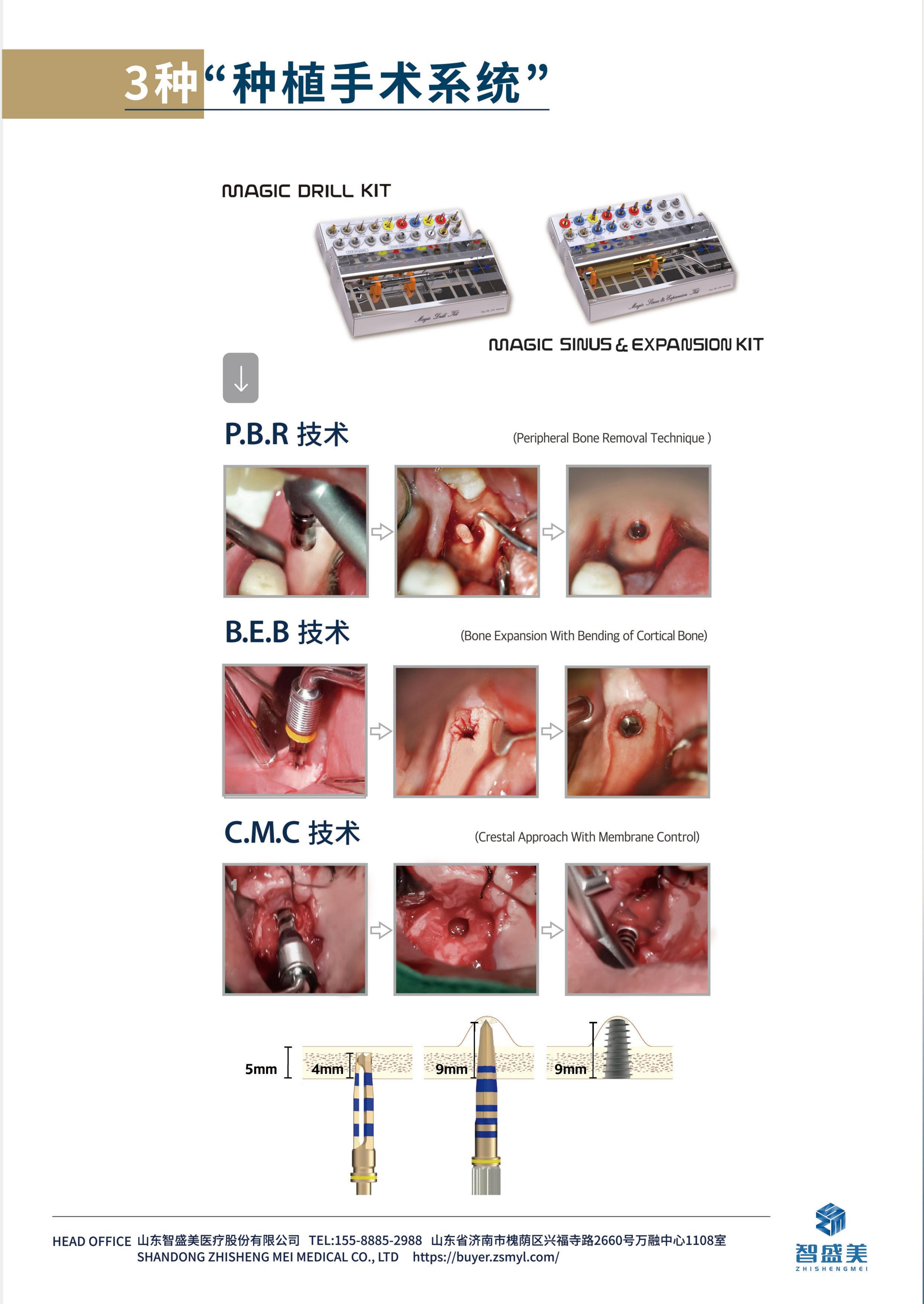 种植牙黑科技！IBS-FC种植体，重新定义缺牙修复